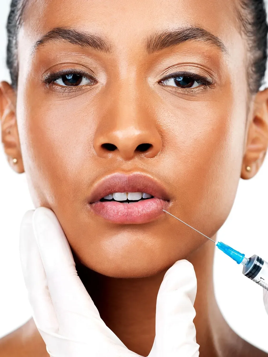 Dermal Fillers